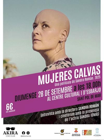 mujeres calvas